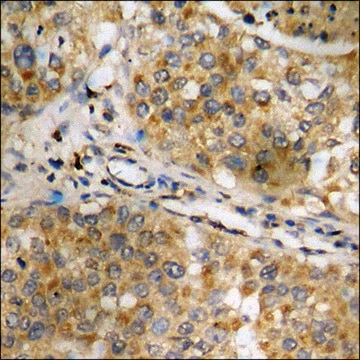 Anti-phospho-NF-kappaB p65 (pSer468) antibody produced in rabbit affinity isolated antibody