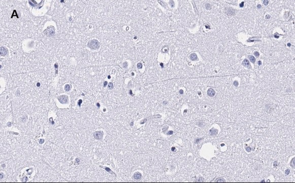 Anti-MBP Antibody, clone 2N6 , ZooMAb&#174; Rabbit Monoclonal recombinant, expressed in HEK 293 cells