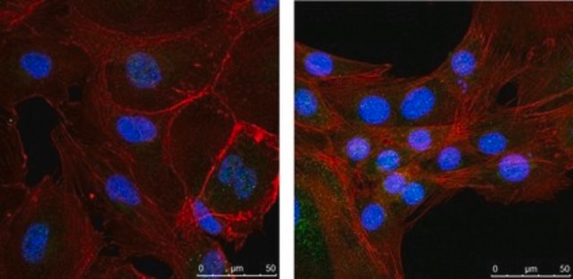 Anti-NR4A1 (Nur77) from rabbit, purified by affinity chromatography