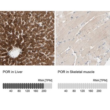 Anti-POR antibody produced in rabbit Prestige Antibodies&#174; Powered by Atlas Antibodies, affinity isolated antibody, buffered aqueous glycerol solution