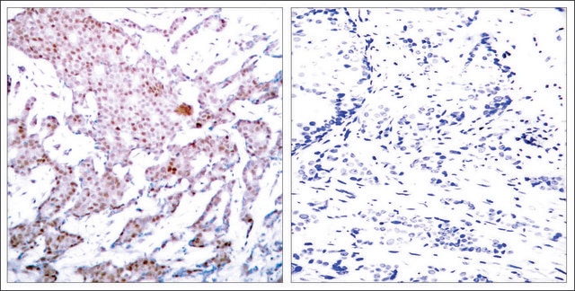 Anti-phospho-RELA (p65/pSer536) antibody produced in rabbit affinity isolated antibody