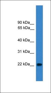 Anti-NUDT16L1 antibody produced in rabbit affinity isolated antibody