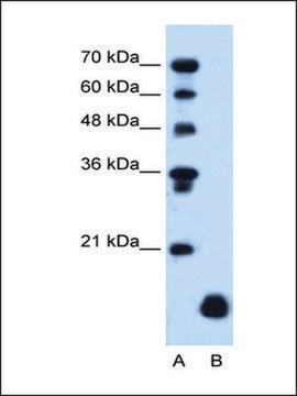 Anti-PLP2 IgG fraction of antiserum