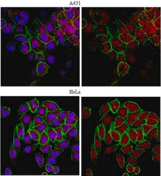 Anti-ERR-alpha P2 Antibody from rabbit