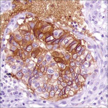 Anti-GLUT-1 antibody, Rabbit monoclonal recombinant, expressed in proprietary host, clone SP168, affinity isolated antibody