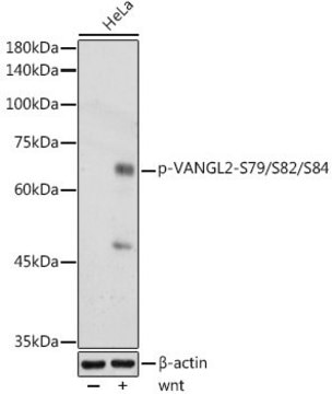 Anti-Phospho-VANGL2-S79/S82/S84 antibody produced in rabbit