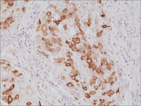 Anti-Surfactant protein A (SP-A) antibody, Rabbit monoclonal recombinant, expressed in HEK 293 cells, clone RM334, purified immunoglobulin