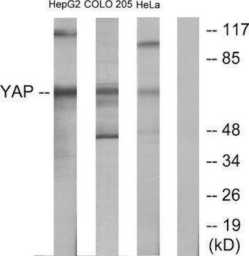 Anti-YAP antibody produced in rabbit affinity isolated antibody