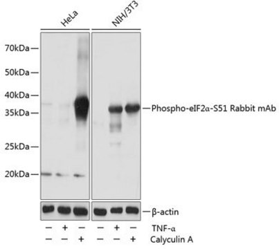 Anti-Phospho-eIF2&#945;-S51 antibody produced in rabbit