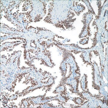 TTF-1 (8G7G3/1) Mouse Monoclonal Antibody