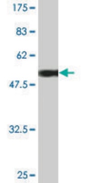 Monoclonal Anti-UCHL1 antibody produced in mouse clone S1, purified immunoglobulin, buffered aqueous solution