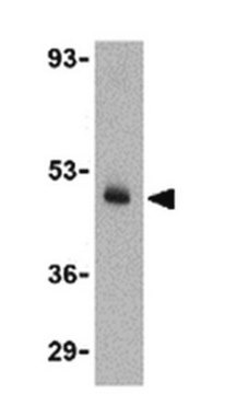 Anti-CX3CL1 Antibody from rabbit, purified by affinity chromatography