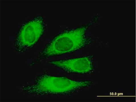 Monoclonal Anti-TG antibody produced in mouse clone 1G3, purified immunoglobulin, buffered aqueous solution