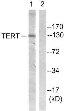 Anti-Telomerase antibody produced in rabbit affinity isolated antibody