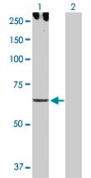 Anti-CDH6 antibody produced in rabbit purified immunoglobulin, buffered aqueous solution