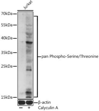 Anti-pan Phospho-Serine/Threonine antibody produced in rabbit