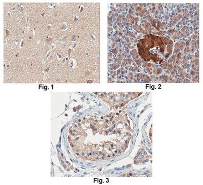 Anti-Prohormone Convertase PC2 Antibody from rabbit, purified by affinity chromatography