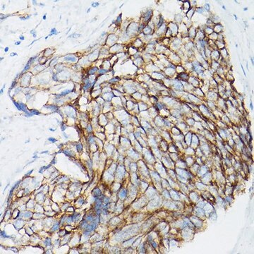 Anti- &#946;-Catenin antibody produced in rabbit