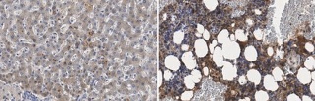 Anti-Alpha-2-HS-Glycoprotein from rabbit, purified by affinity chromatography