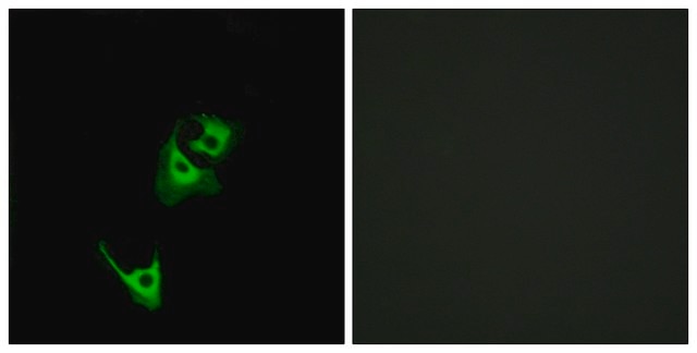 Anti-GLP1R antibody produced in rabbit affinity isolated antibody