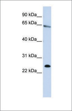 Anti-ZNF326 antibody produced in rabbit affinity isolated antibody