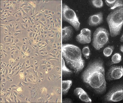 Human Bronchial Epithelial Cells: HBEpC, adult