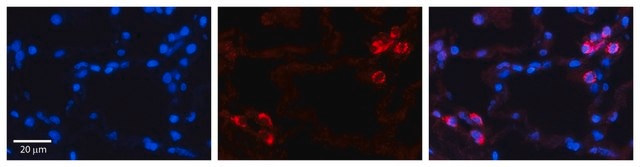 Anti-IGFBP7 antibody produced in rabbit affinity isolated antibody