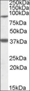 Anti-LASS1 antibody produced in goat affinity isolated antibody, buffered aqueous solution