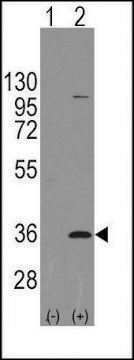 Anti-PARP16 (C-term) antibody produced in rabbit saturated ammonium sulfate (SAS) precipitated, buffered aqueous solution