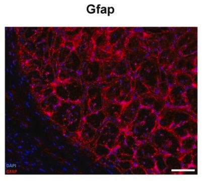 Anti-GFAP antibody produced in rabbit affinity isolated antibody