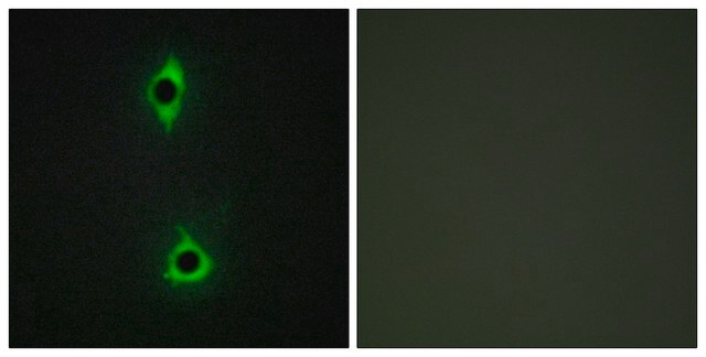 Anti-PIP5K antibody produced in rabbit affinity isolated antibody