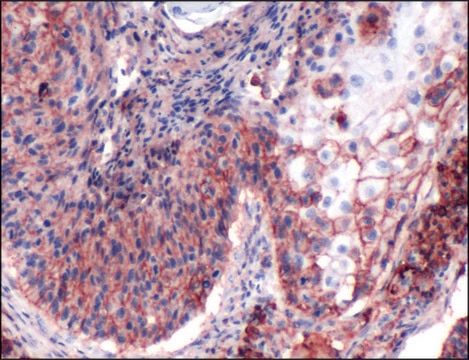 Anti-CD44 antibody, Rabbit monoclonal recombinant, expressed in proprietary host, clone SP37, tissue culture supernatant