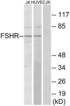 Anti-FSHR antibody produced in rabbit affinity isolated antibody