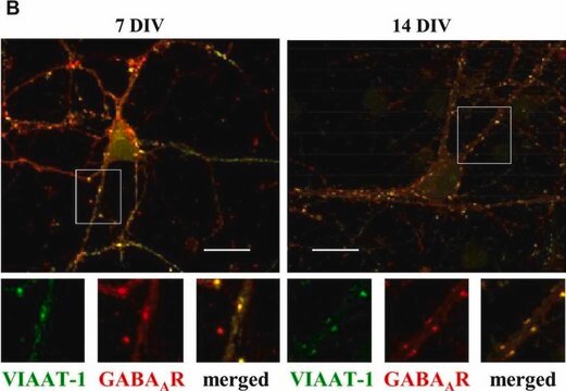 Anti-GABA A Receptor &#946; 2,3 Chain Antibody, clone BD17 clone BD17, Chemicon&#174;, from mouse