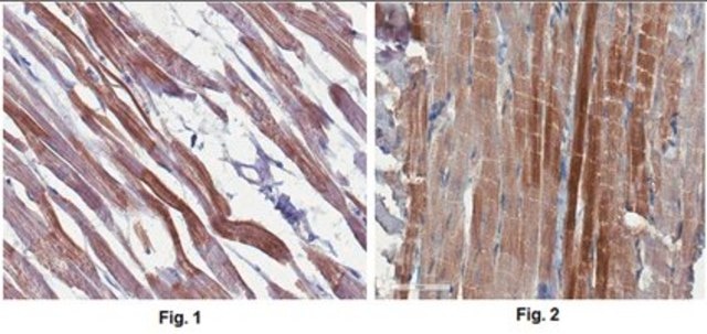 Anti-ANKRD1/CARP Antibody, clone 12G8.2 clone 12G8.2, from mouse