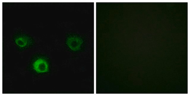 Anti-CCR4 antibody produced in rabbit affinity isolated antibody