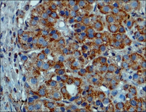 Anti-BRAF (V600E) antibody, Rabbit monoclonal recombinant, expressed in HEK 293 cells, clone RM8, purified immunoglobulin