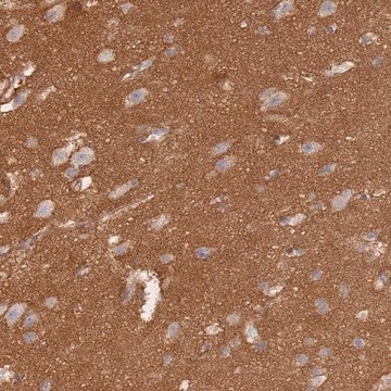 Anti-GNB4 antibody produced in rabbit Prestige Antibodies&#174; Powered by Atlas Antibodies, affinity isolated antibody, buffered aqueous glycerol solution