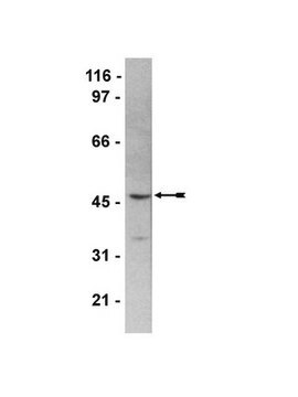 Anti-HDAC8 Antibody serum, Upstate&#174;