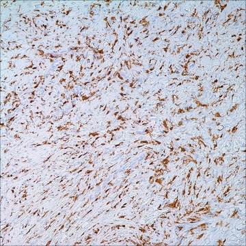 Factor XIIIa (EP3372) Rabbit Monoclonal Primary Antibody