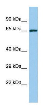 Anti-YTHDF2 (C-terminal) antibody produced in rabbit affinity isolated antibody