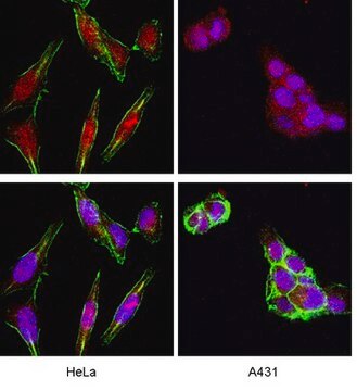 Anti-Akt/PKB Antibody, PH Domain, clone SKB1 clone SKB1, Upstate&#174;, from mouse