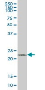 Anti-VHL antibody produced in mouse purified immunoglobulin, buffered aqueous solution