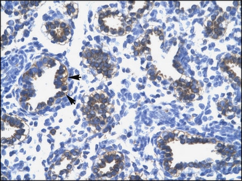 Anti-RPS16 (AB1) antibody produced in rabbit IgG fraction of antiserum