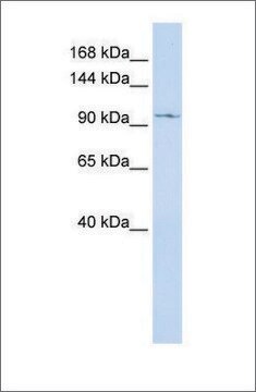 Anti-TRPC6 antibody produced in rabbit affinity isolated antibody