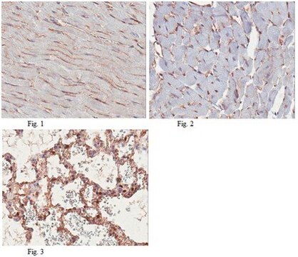 Anti-PTRF/cavin-1 Antibody from rabbit, purified by affinity chromatography