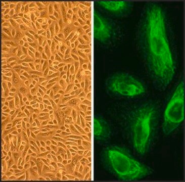 Human Placental Epithelial Cells: HPlEpC, fetal