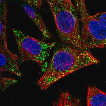 Anti-CTNNBIP1 antibody produced in rabbit Prestige Antibodies&#174; Powered by Atlas Antibodies, affinity isolated antibody