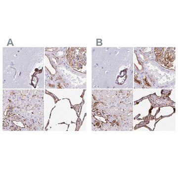 Anti-ANXA2 Prestige Antibodies&#174; Powered by Atlas Antibodies, affinity isolated antibody