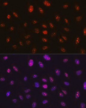 Anti- RB antibody produced in rabbit